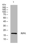Western blot analysis of lysates from U2OS cells, primary antibody was diluted at 1:1000, 4°C overnight STJ195689