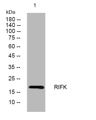 Western blot analysis of lysates from U2OS cells, primary antibody was diluted at 1:1000, 4°C overnight STJ195689