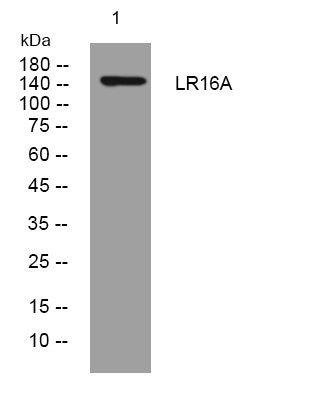 Western blot analysis of lysates from U2OS cells, primary antibody was diluted at 1:1000, 4° overnight STJ195878