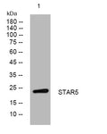 Western blot analysis of lysates from U2OS cells, primary antibody was diluted at 1:1000, 4° overnight STJ196100