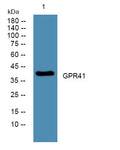 Western blot analysis of lysates from U2OS cells, primary antibody was diluted at 1:1000, 4°C overnight STJ93385