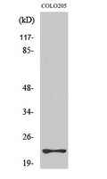Western blot analysis of various cells using Rho D Polyclonal Antibody diluted at 1:500 STJ95444