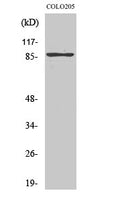 Western blot analysis of various cells using TLK2 polyclonal antibody. Secondary antibody was STJ96039