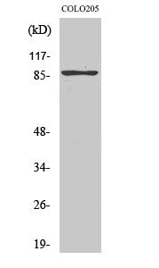 Western blot analysis of various cells using TLK2 polyclonal antibody. Secondary antibody was STJ96039