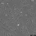 Wilms1 cell