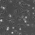Wilms10T cell