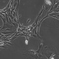 Wilms11 cell