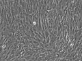 Wilms2 cell