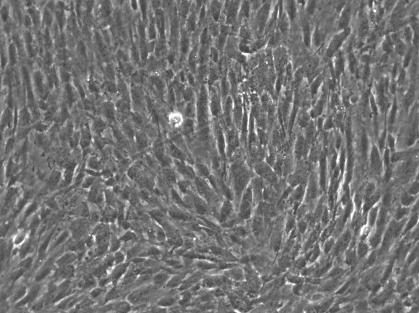 Wilms2 cell