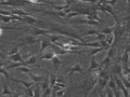 Wilms3 cell