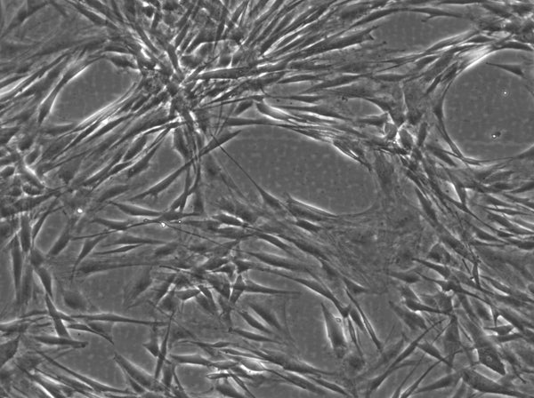 Wilms6 cell