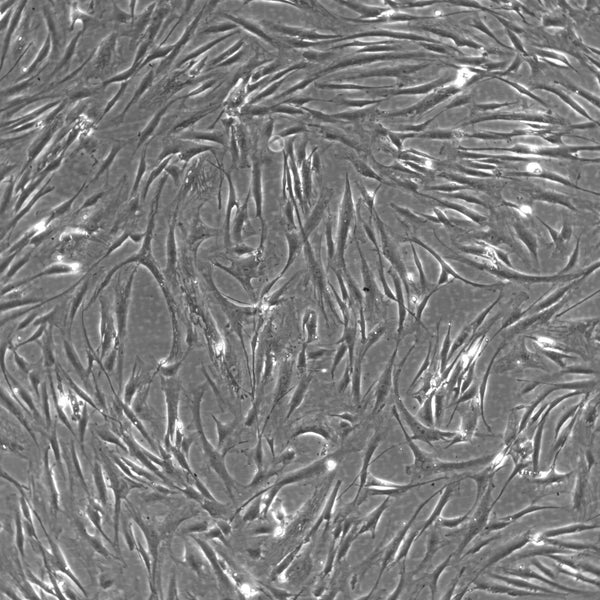 Wilms8 cell