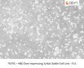 HBZ Over-expressing Jurkat Stable Cell Line - F11 | Applied Biological Materials (abm)