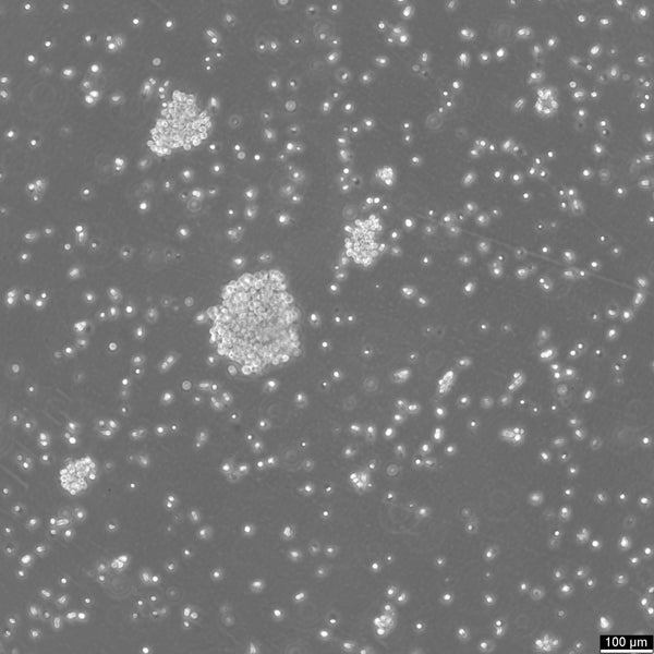 WT100 cell