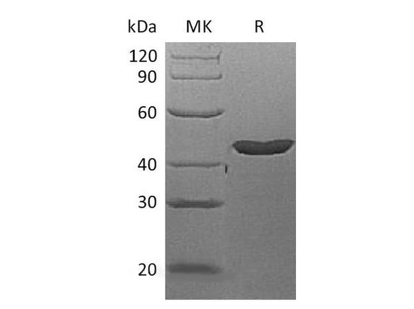 Recombinant Human LEFTY2 Protein (His Tag) – Figure 1 of 2