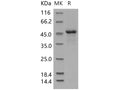 Recombinant Human ILKAP Protein (His Tag) – Figure 1 of 2
