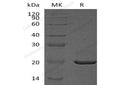 Recombinant Human CRYAA Protein (His Tag) – Figure 1 of 2