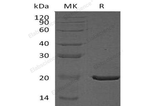 Recombinant Human CRYAA Protein (His Tag) – Figure 1 of 2
