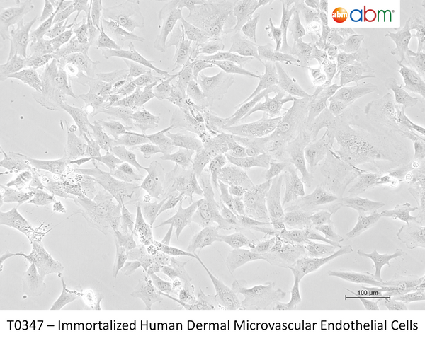 Immortalized Human Dermal Microvascular Endothelial Cells – Figure 1 of 1