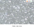 HBL-3 Cells – Figure 1 of 1