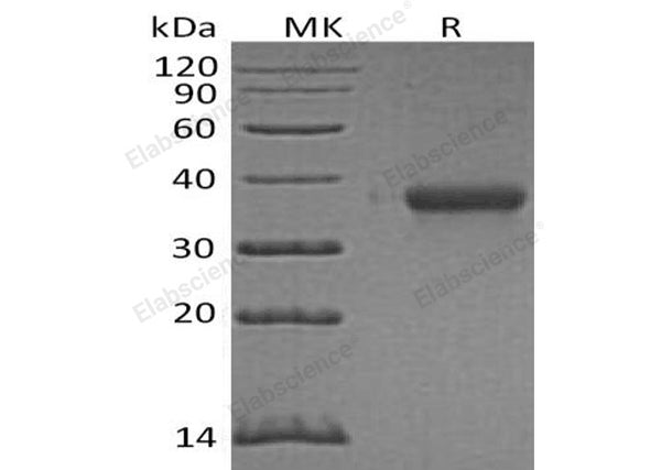 Recombinant Human Ephrin-A3/EFNA3 Protein (His Tag) – Figure 1 of 2
