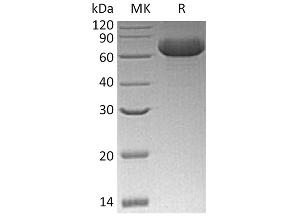 Recombinant Human GFRRA2 Protein (His Tag) – Figure 1 of 2