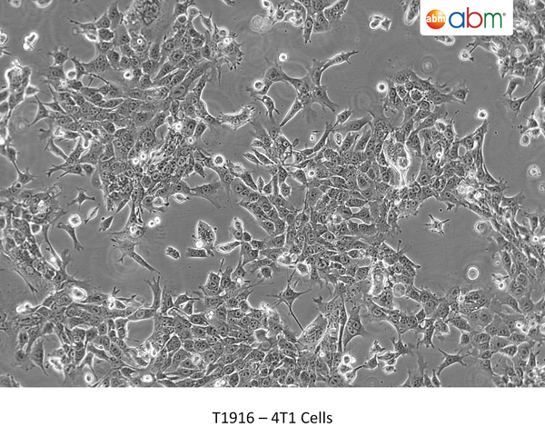 4T1 Cells – Figure 1 of 1