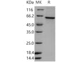 Recombinant Human TERF1/TRF1 Protein (His Tag) – Figure 1 of 2