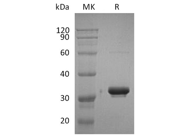 Recombinant Human IgG2-Fc Protein – Figure 1 of 2