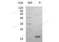 Recombinant Human Galectin-14/LGALS14 Protein (His Tag) – Figure 1 of 2