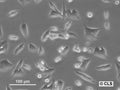 Y-1 cell