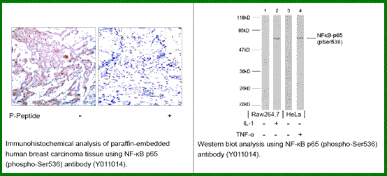 Anti-NF-kB p65 (Phospho-Ser536) Antibody – Figure 1 of 1