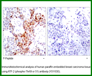 Anti-ATF2 (Phospho-Thr51(Thr69)) Antibody – Figure 1 of 1