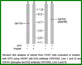 Anti-GATA1 (Phospho-Ser310) Antibody – Figure 1 of 1
