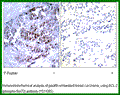 Anti-BCL (Phospho-Ser70) Antibody – Figure 1 of 1
