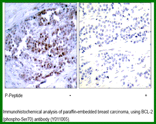 Anti-BCL (Phospho-Ser70) Antibody – Figure 1 of 1