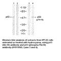 Anti-p53 (Phospho-Thr18) Antibody – Figure 1 of 1