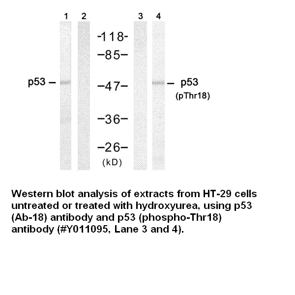 Anti-p53 (Phospho-Thr18) Antibody – Figure 1 of 1