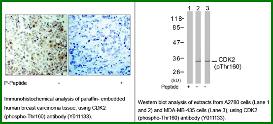 Anti-CDK2 (Phospho-Thr160) Antibody – Figure 1 of 1