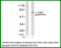 Anti-Chk2 (Phospho-Ser516) Antibody – Figure 1 of 1