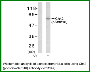 Anti-Chk2 (Phospho-Ser516) Antibody – Figure 1 of 1