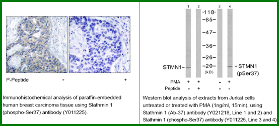 Anti-Stathmin 1 (Phospho-Ser37) Antibody – Figure 1 of 1