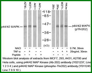 Anti-p44/42 MAP Kinase (Phospho-Thr202) Antibody – Figure 1 of 1
