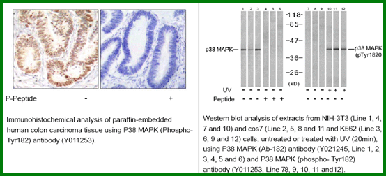 Anti-p38 MAPK (Phospho-Tyr182) Antibody – Figure 1 of 1