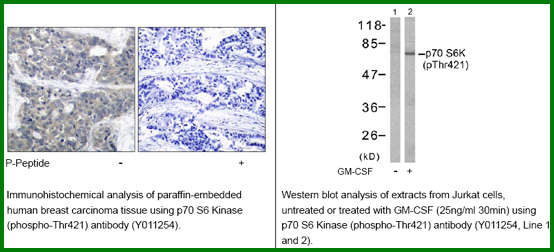 Anti-p70 S6 Kinase (Phospho-Thr421) Antibody – Figure 1 of 1