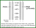 Anti-PKR (Phospho-Thr446) Antibody – Figure 1 of 1