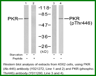 Anti-PKR (Phospho-Thr446) Antibody – Figure 1 of 1