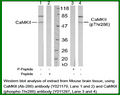Anti-CaMKII (Phospho-Thr286) Antibody – Figure 1 of 1