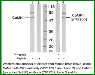Anti-CaMKII (Phospho-Thr286) Antibody – Figure 1 of 1
