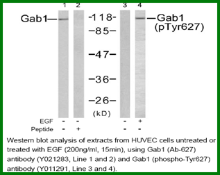 Anti-Gab1 (Phospho-Tyr627) Antibody – Figure 1 of 1